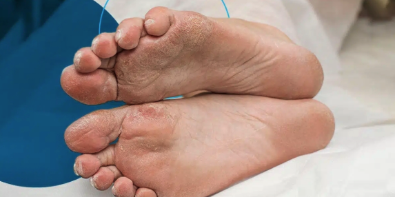 How Everyday Habits Affect Foot Health How Everyday Habits Affect Foot Health
