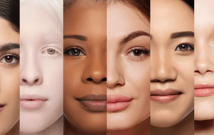 Choosing the Right Dermatologist for Skin Treatments